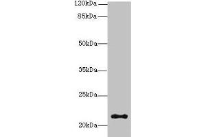 Western blot All lanes: JAGN1 antibody at 3 μg/mL + HL60 whole cell lysate Secondary Goat polyclonal to rabbit IgG at 1/10000 dilution Predicted band size: 22 kDa Observed band size: 22 kDa (JAGN1 antibody  (AA 1-39))