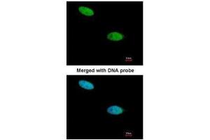 ICC/IF Image Immunofluorescence analysis of paraformaldehyde-fixed HeLa, using DUSP26, antibody at 1:200 dilution. (DUSP26 antibody  (Center))