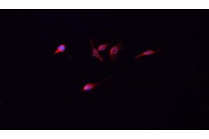 Immunofluorescence (fixed cells) (IF/ICC) image for anti-Tumor Protein P53 (TP53) (acLys319) antibody (ABIN6254862)