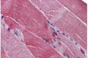 Human Skeletal Muscle: Formalin-Fixed, Paraffin-Embedded (FFPE) (PCSK6 antibody  (AA 830-841))