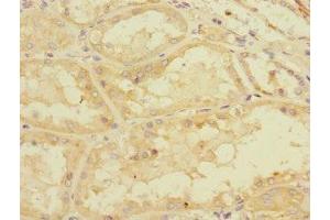 Immunohistochemistry of paraffin-embedded human kidney tissue using ABIN7160526 at dilution of 1:100 (PDE4DIP antibody  (AA 1-310))