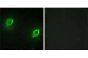 Immunofluorescence analysis of HeLa cells, using AKAP5 Antibody. (AKAP5 antibody  (AA 1-50))
