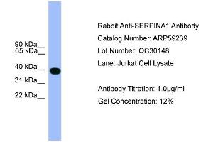 WB Suggested Anti-SERPINA1  Antibody Titration: 0. (SERPINA1 antibody  (C-Term))