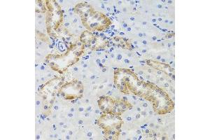 Immunohistochemistry of paraffin-embedded rat kidney using MTERFD3 antibody at dilution of 1:100 (x40 lens). (MTERFD3 antibody)