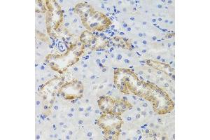 Immunohistochemistry of paraffin-embedded rat kidney using MTERFD3 antibody at dilution of 1:100 (x40 lens). (MTERFD3 antibody)