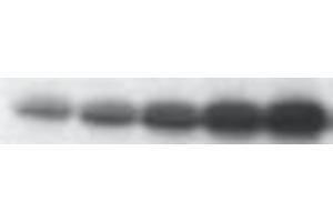 Western Blotting (WB) image for anti-Tumor Protein P53 (TP53) (pSer46) antibody (ABIN3201005)