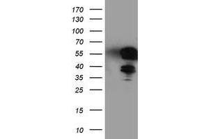 HEK293T cells were transfected with the pCMV6-ENTRY control (Left lane) or pCMV6-ENTRY TAL1 (Right lane) cDNA for 48 hrs and lysed. (TAL1 antibody)