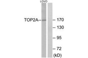 Image no. 2 for anti-Topoisomerase (DNA) II alpha 170kDa (TOP2A) (AA 1081-1130) antibody (ABIN2888905) (Topoisomerase II alpha antibody  (AA 1081-1130))