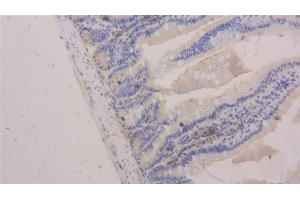 Immunohistochemistry (IHC) image for anti-Platelet/endothelial Cell Adhesion Molecule (PECAM1) (AA 78-214) antibody (ABIN7431653)