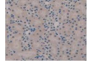 Figure. (TICAM1 antibody  (AA 263-526))