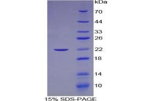 SDS-PAGE of Protein Standard from the Kit  (Highly purified E. (LAMC2 ELISA Kit)