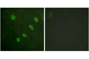 Immunofluorescence analysis of HeLa cells, using ATF2 (Phospho-Ser480) Antibody. (ATF2 antibody  (pSer480))