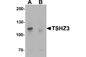 Western blot analysis of TSHZ3 in mouse brain tissue lysate with TSHZ3 antibody at 1 µg/mL in (A) the absence and (B) the presence of blocking peptide.