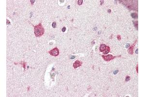 Human Brain, Cortex (formalin-fixed, paraffin-embedded) stained with TSLPat 2. (Thymic Stromal Lymphopoietin antibody)