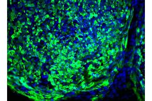 Immunofluorescent staining of human ES cell line (TRA1-60 antibody)