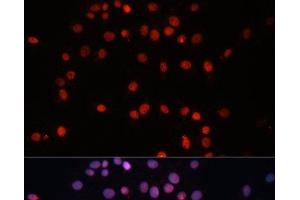 Immunofluorescence (IF) image for anti-Small Ubiquitin Related Modifier Protein 1 (SUMO1) antibody (ABIN7260199)