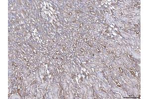 IHC analysis of ANXA4 using anti-ANXA4 antibody (ABIN5518805). (Annexin IV antibody  (Middle Region))