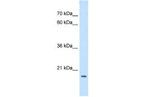 ASF1B antibody used at 1 ug/ml to detect target protein. (ASF1B antibody)