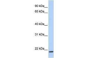 WB Suggested Anti-TMEM35 Antibody Titration:  0.