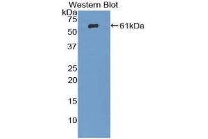 Western Blotting (WB) image for anti-beta-Adrenergic Receptor Kinase (AA 398-640) antibody (ABIN1857927) (beta-Adrenergic Receptor Kinase (AA 398-640) antibody)