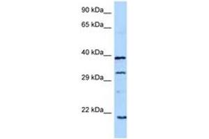 Image no. 1 for anti-Growth Hormone 1 (GH1) (C-Term) antibody (ABIN6748200)