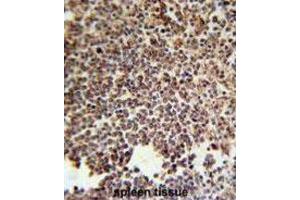 Immunohistochemistry (IHC) image for anti-Killer Cell Immunoglobulin-Like Receptor, Two Domains, Short Cytoplasmic Tail, 3 (KIR2DS3) antibody (ABIN3002434) (KIR2DS3 antibody)
