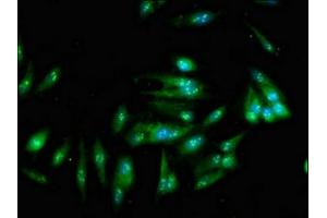 Immunofluorescent analysis of Hela cells using ABIN7170696 at dilution of 1:100 and Alexa Fluor 488-congugated AffiniPure Goat Anti-Rabbit IgG(H+L) (SND1 antibody  (AA 560-732))