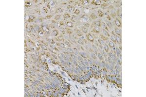 Immunohistochemistry of paraffin-embedded human esophagus using EFN Antibody (ABIN6127874, ABIN6139961, ABIN6139962 and ABIN6220974) at dilution of 1:100 (40x lens). (Ephrin A1 antibody  (AA 19-182))