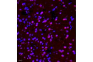 Immunofluorescence of paraffin embedded mouse brain using ptgds (ABIN7075207) at dilution of 1:1700 (400x lens)