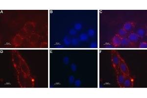 Expression of Melanin-concentrating hormone receptor 1 in mouse brain glioma - Cell surface detection of MCHR1 in mouse brain glioma (C6) intact living cells. (MCHR1 antibody  (Extracellular))