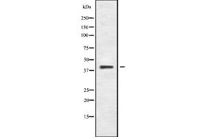 Western blot analysis of CCR8 using COLO205 whole cell lysates (CCR8 antibody  (C-Term))