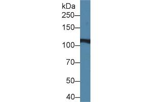 Western blot analysis of Rat Liver lysate, using Rat IREB2 Antibody (2 µg/ml) and HRP-conjugated Goat Anti-Rabbit antibody (