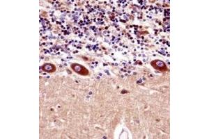 Immunohistochemistry analysis in formalin fixed and paraffin embedded human cerebellum tissuereacted with KCNA1 Antibody (Center) followed which was peroxidase conjugated to the secondary antibody and followed by DAB staining.
