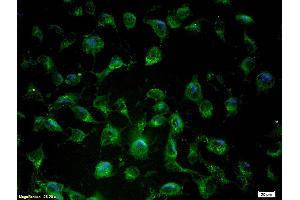 Cultured endothelial cells labeled with Anti-Nos-3/ENOSPolyclonal Antibody (ABIN725690), Unconjugated, followed by conjugation to the secondary antibody Goat Anti-Rabbit IgG,FITC conjugated at 1:200 dilution for 40 min. (ENOS antibody  (AA 1105-1202))