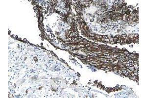 Immunohistochemistry (IHC) image for anti-Podoplanin (PDPN) antibody (ABIN180856) (Podoplanin antibody)
