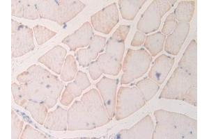 Detection of MYL6B in Rat Skeletal muscle Tissue using Polyclonal Antibody to Myosin Light Chain 6B, Alkali, Smooth Muscle And Non Muscle (MYL6B) (MYL6B antibody  (AA 6-137))