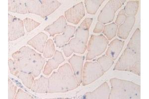 Detection of MYL6B in Rat Skeletal muscle Tissue using Polyclonal Antibody to Myosin Light Chain 6B, Alkali, Smooth Muscle And Non Muscle (MYL6B) (MYL6B antibody  (AA 6-137))