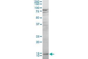 KLRF1 polyclonal antibody (A01), Lot # 051214JC01. (KLRF1 antibody  (AA 69-166))