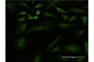 Immunofluorescence of monoclonal antibody to ULK2 on HeLa cell. (ULK2 antibody  (AA 743-843))