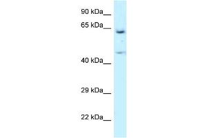 WB Suggested Anti-NARS Antibody Titration: 1. (NARS antibody  (N-Term))