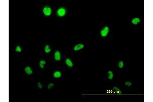 Immunofluorescence of monoclonal antibody to TSSK1 on HeLa cell. (TSSK1B antibody  (AA 267-367))