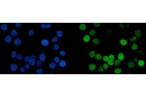 IF analysis of MCM6 using anti-MCM6 antibody (ABIN7600038). (MCM6 antibody  (AA 14-821))