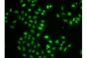Immunofluorescence analysis of MCF-7 cells using DUSP22 antibody.
