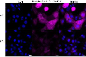 Immunocytochemical staining of HT- cells using Phospho-Cyclin B1 (Ser126) antibody (ABIN7798192), 1:1,000), Top panel: wild-type (WT), Bottom panal: Phospho-Cyclin B1 (Ser126) shRNA knockdown (KD). (Recombinant Cyclin B1 antibody  (pSer126))