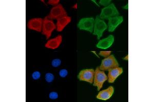 ABIN6261103 and ABIN6276877 staining Hela cells by IF/ICC.