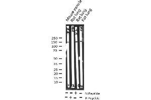 Western Blotting (WB) image for anti-Phospholipase C gamma 2 (PLCG2) (pTyr753) antibody (ABIN6256017)