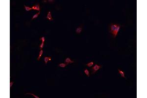 ABIN6266681 staining SNKSH cells by IF/ICC. (NK6 Homeobox 3 antibody  (Internal Region))