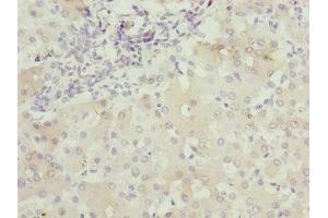 Immunohistochemistry of paraffin-embedded human liver tissue using ABIN7175453 at dilution of 1:100 (BNIP1 antibody  (AA 1-200))