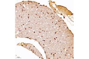 Immunohistochemistry (Paraffin-embedded Sections) (IHC (p)) image for anti-Ubiquitin Specific Peptidase 34 (USP34) antibody (ABIN7076115)