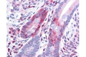 Immunohistochemistry (IHC) image for anti-Programmed Cell Death 4 (PDCD4) (pSer457) antibody (ABIN400797) (PDCD4 antibody  (pSer457))